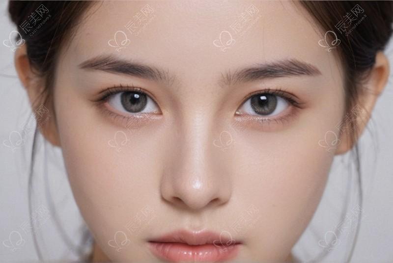  痘痘肌红肿痘怎么办？紧急处理的小方法