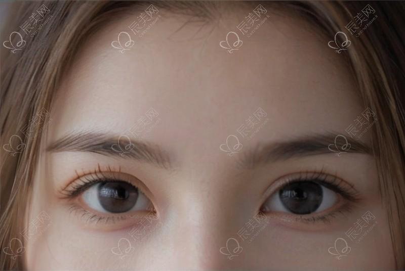敏感肌易过敏如何应对？5个冷门习惯，解锁肌肤抗敏密码