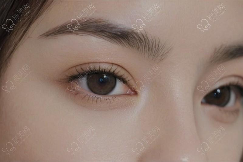 体毛生长速度差异？腋下/四肢/私密部位不同