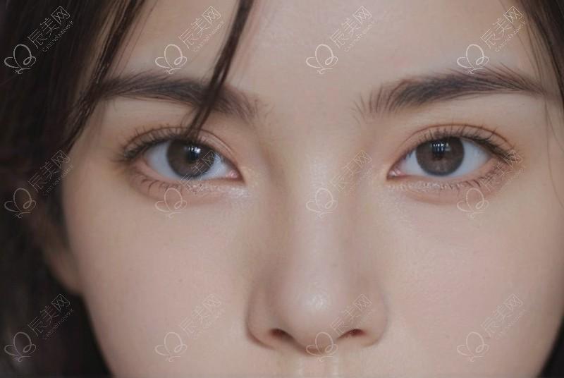 温水润唇后轻抿嘴，促唇部水分吸收。