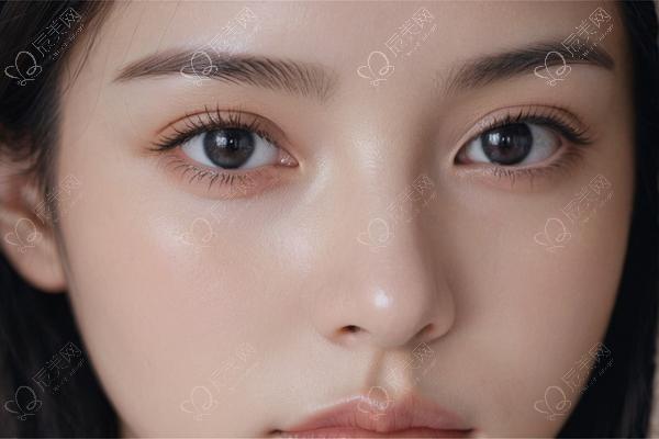 眼睑脂肪粒用含寡肽的眼霜，修复肌肤减少颗粒​