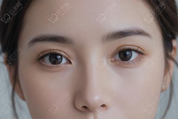 抬头纹、鱼尾纹、川字纹，打肉毒有啥区别？