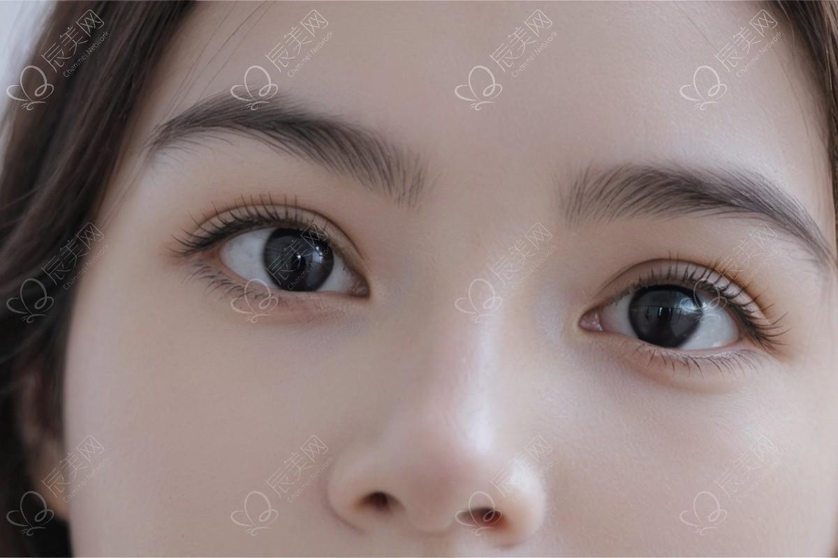 沈阳隆鼻塑形看这里！形态自然持久度好的私立医院：杏林/美莱/北方参考名单！