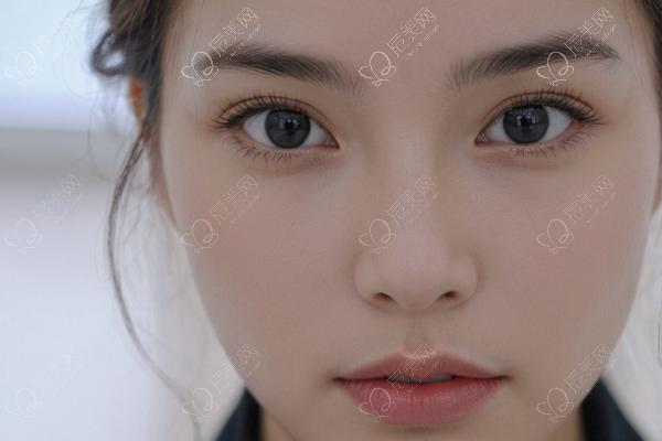 双眼皮做坏了？修复咋逆袭成妈生款  